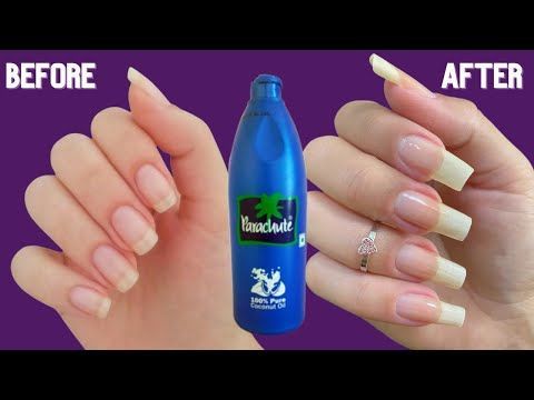 How To Grow Nails Faster Nail Growth Tips Faster, How To Whiten Nails, White Spots On Nails, Make Nails Grow, Fast Drying Nail Polish, Nail Whitening, Grow Long Nails, Nail Growth Tips, Nail Care Diy