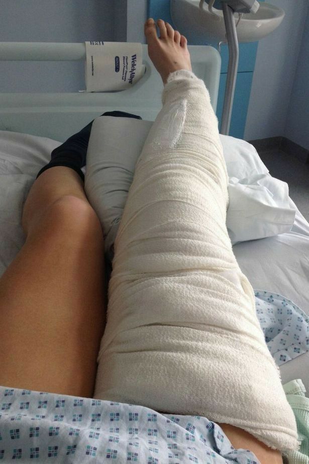 a person laying in a hospital bed with a cast on their leg