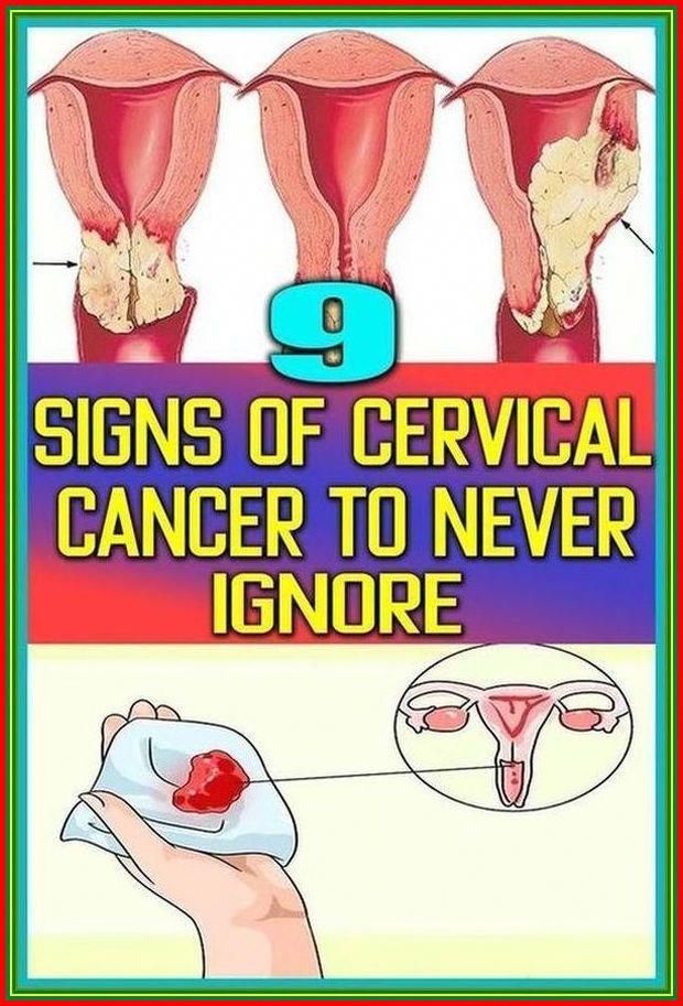 7 warning symptoms of  - cervical cancer that every women should know by Steven Johnston | This newsletter was created with Smore, an online tool for creating beautiful newsletters for educators, businesses and more Health Signs, Types Of Cancers, Signs And Symptoms, Warning Signs, Oral Health, Oral Care, Parenting Hacks, Health Tips, Parenting