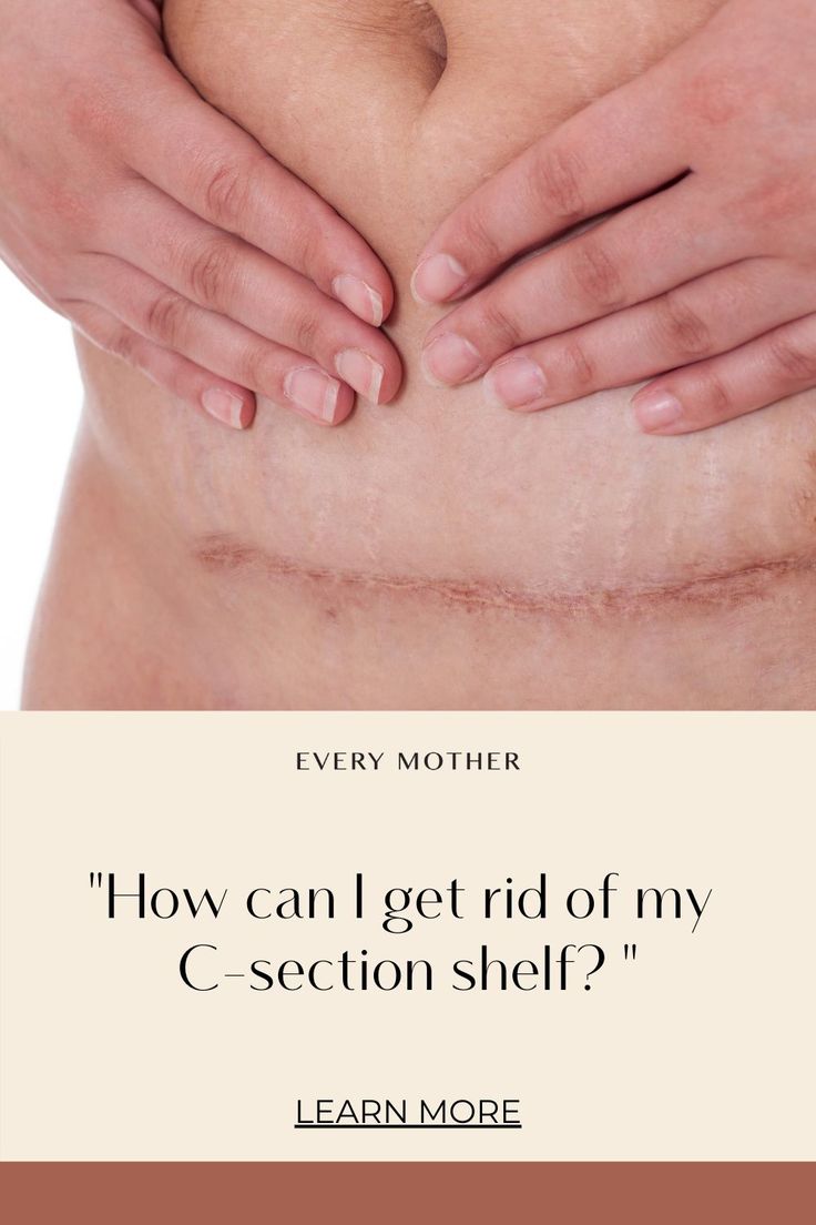 a woman's stomach with the words how can i get rid of my c - section shelf?