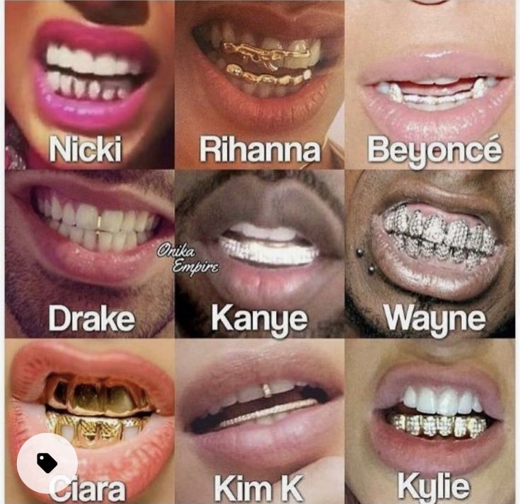 Gold Braces, Teeth Aesthetic, Teeth Gems, Silver Grillz, Pretty Teeth, Grillz Teeth, Cute Braces, Diamond Teeth, Braces Colors