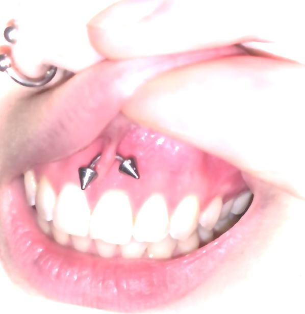 a close up of a person's mouth with two piercings on the teeth