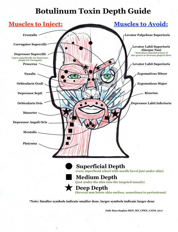 Botox Vs Jeuveau, Starting A Botox Business, Botox Tips And Tricks, Botox Training For Nurses, Diy Botox Injections, Dao Botox Injection, Cosmetic Nurse Injector, Botox Studio Ideas, Botox Information