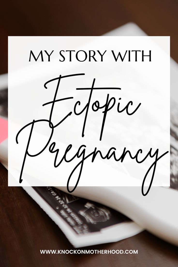 the words, my story with ectopic pragnancy on top of two books