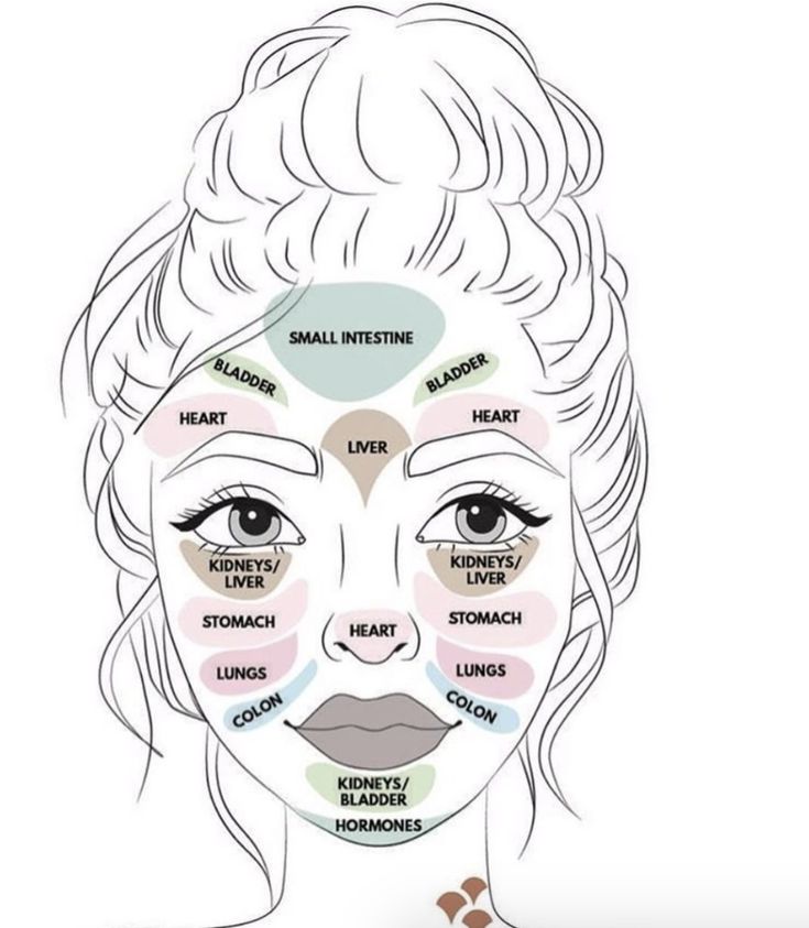 Wondering if there is a connection between acne and each organ in your body? There is! ✨- map of acne on face - face acne map - face acne chart - face acne meaning - map of acne on face - skincare routine - skincare tips - #skincare #acne Face Acne Remedies, Facial Mapping, Acne Chart, Best Acne Scar Removal, Skin Mapping, Jade Face Roller, Facial Massage Roller, Face Skin Care Routine, Face Mapping