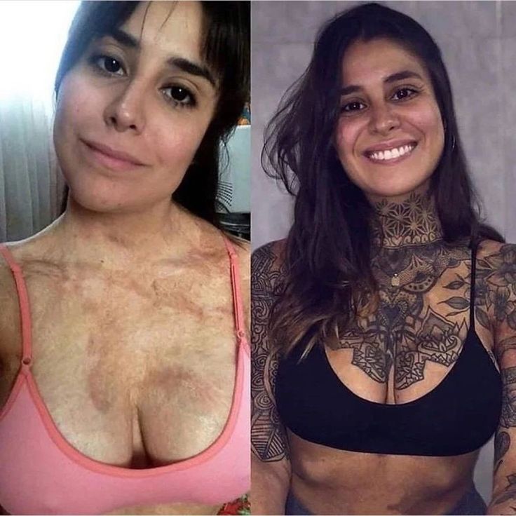 two women with tattoos on their chest and one without