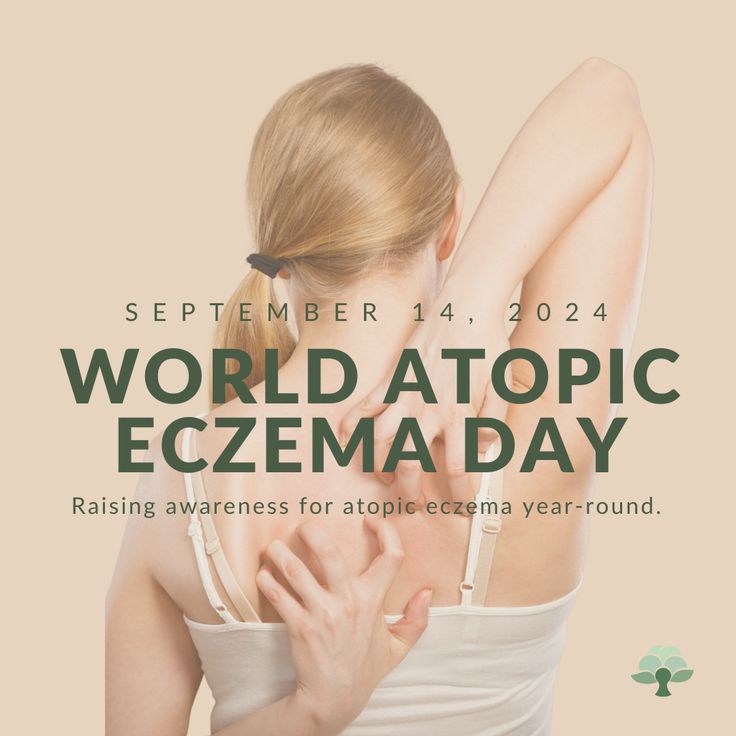 Atopic eczema, or atopic dermatitis, is a chronic skin condition causing redness, itching, and discomfort. It affects millions worldwide, making daily life difficult for many.

While September 14th raises awareness, the journey to understanding and managing eczema is ongoing. Education and support are key to improving lives and advocating for better treatments.

Join us in spreading awareness and supporting those affected. Clothing Tips, Skin Condition, Medical Research, Life Improvement, Social Responsibility, Clothing Essentials, Skin Conditions, The Journey, Daily Life