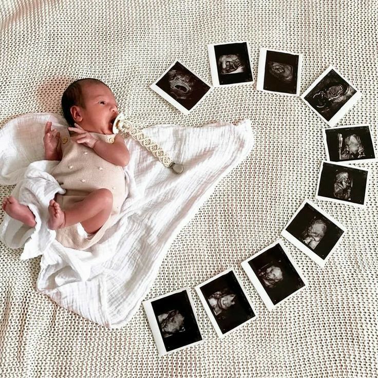 a baby laying on top of a white blanket next to many black and white photos