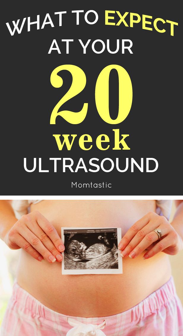 a pregnant belly with the words what to expect at your 20 week ultrasound