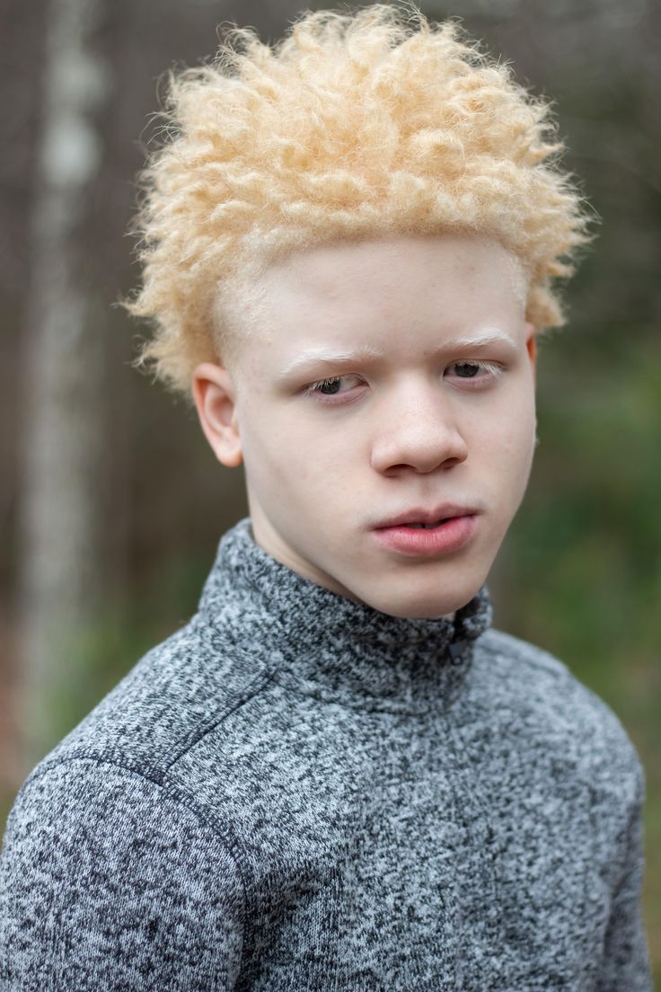 Albino Black Men, Pregnant Man, Black King And Queen, Dragon Princess, Full Brows, Targaryen Aesthetic, Boy Face, Black Person, Unique Kids