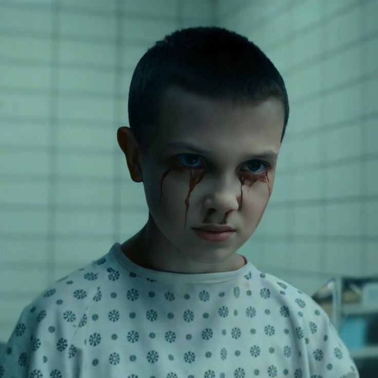 a young boy with blood all over his face and nose, standing in a hospital room