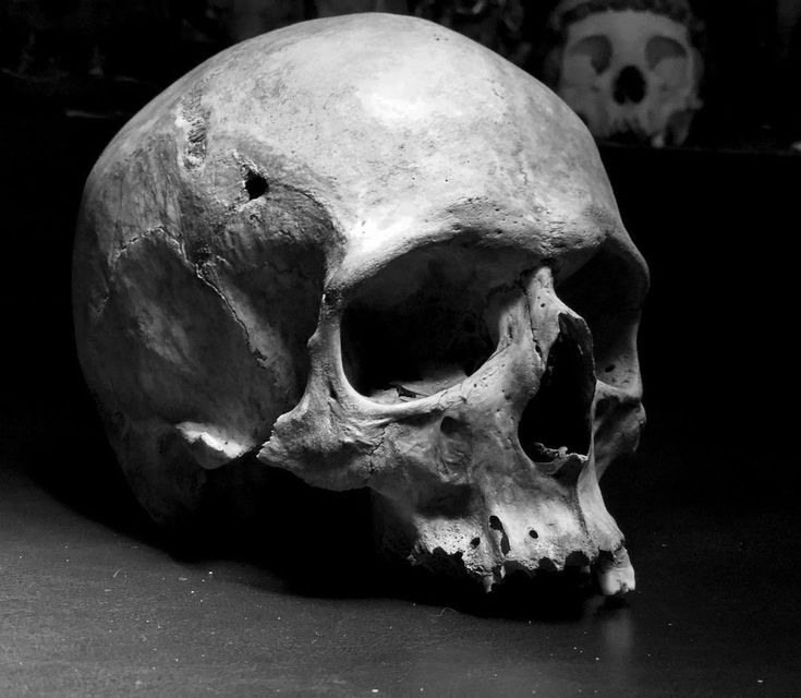 a black and white photo of a human skull