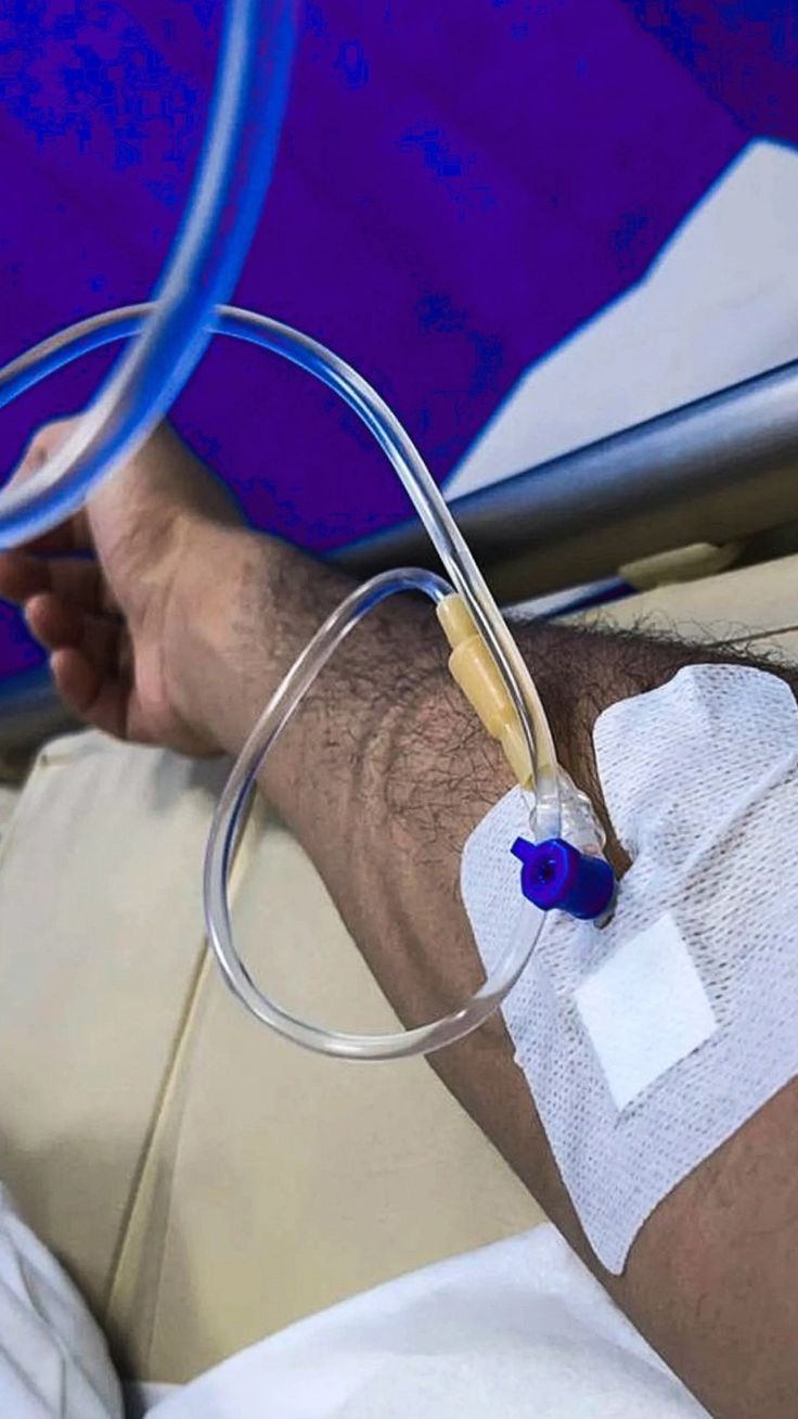 a man laying in a hospital bed with an iv tube attached to his arm and hand