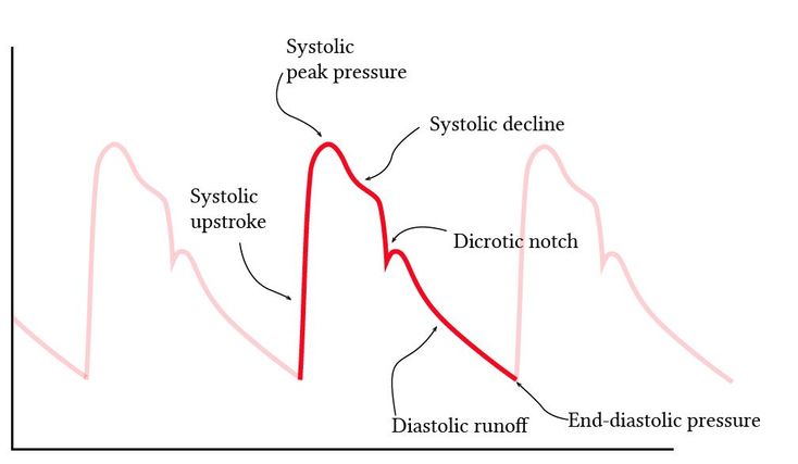 Arterial Line Nursing, Arterial Blood Gases Nursing, Arterial Line, Lower Extremity Arterial Ultrasound, Peripheral Arterial Occlusive Disease, Nurse Purse, Coronary Arteries Disease Nursing, Spontaneous Coronary Artery Dissection, Abdominal Aorta