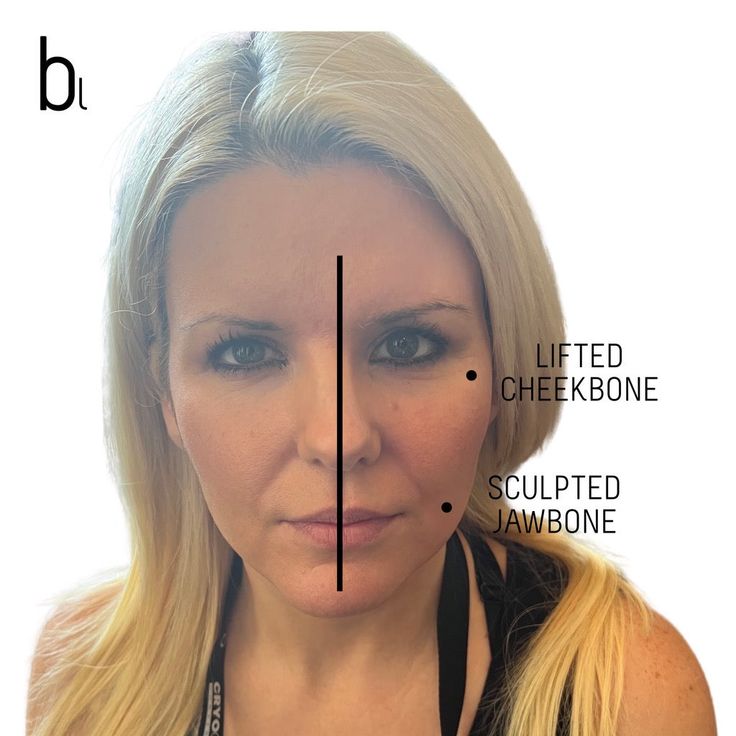 A set of two stainless steel facial tools that combine the benefits of cryotherapy and lymphatic drainage to contour, lift, and detoxify skin for a sculpted, firmer, more radiant appearance. Face Skin Care Products, Facial Tools, Facial Therapy, Decrease Inflammation, Botox Injections, Tighten Pores, Muscle Tone, Facial Massage, Face Skin Care