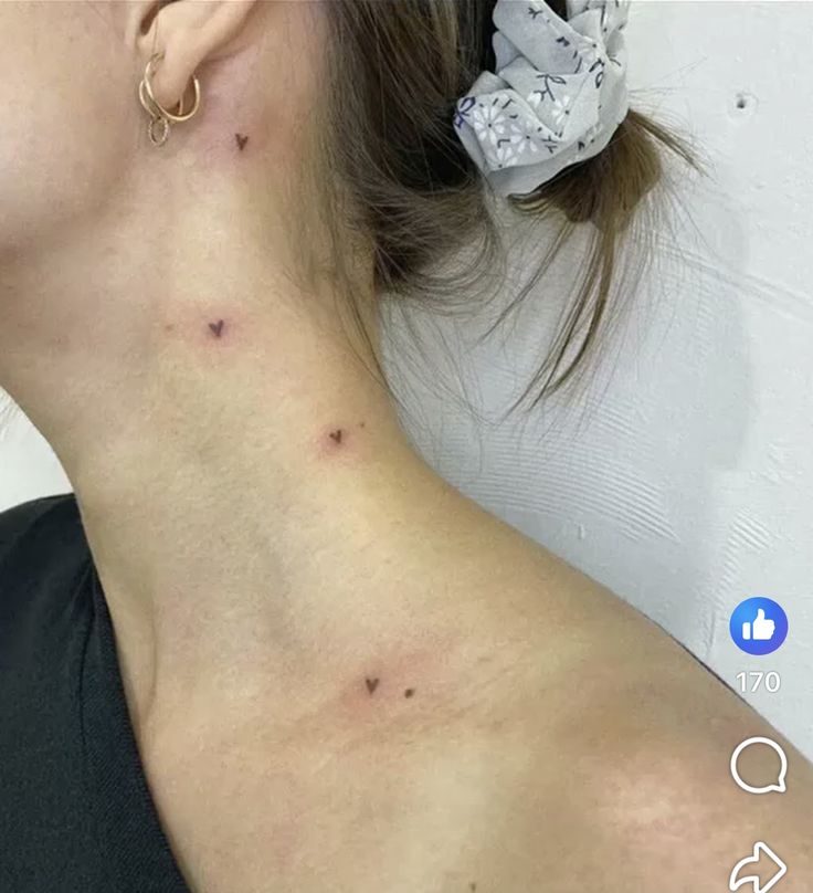 a woman with acne on her neck