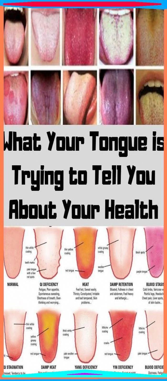 Tongue Problems, Baggy Eyes, Nails And Health, Chest Cold, Healthy On A Budget, Nails Health, Tongue Health, Health Signs, Tongue Cleaner