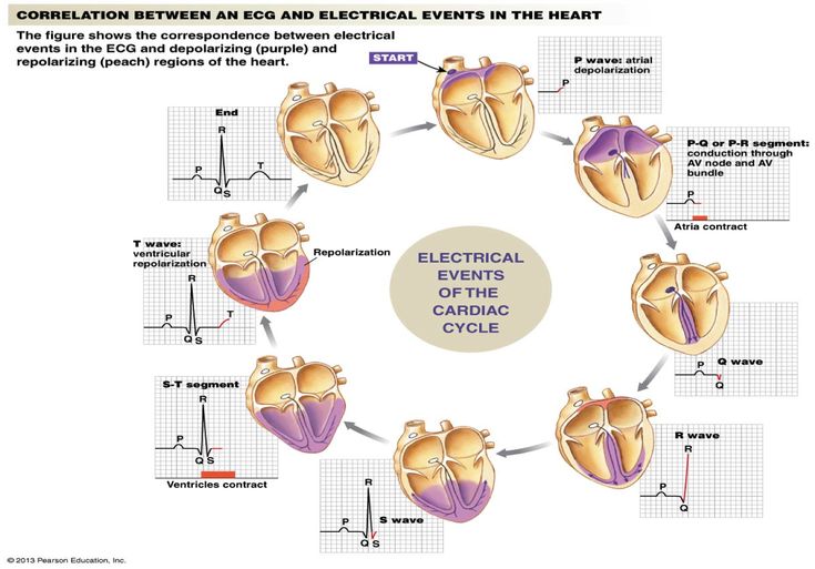 the diagram shows an electrical event in the heart