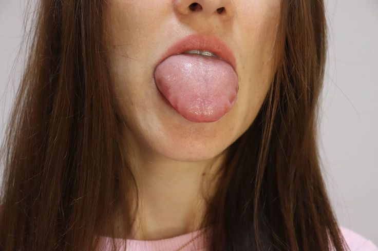 Causes of a Scalloped Tongue | John Douillard's LifeSpa Scalloped Tongue, Pout Face, Thyroid Symptoms, Swollen Tongue, Tongue Health, Liver Detoxification, Nail Care Tips, Nutritional Deficiencies, Best Detox