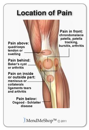 Knee Strain vs Sprain Common Knee Injuries, Knee Ligament Injury, Knee Ligaments, Knee Pain Exercises, Ligament Injury, Knee Exercises, Knee Pain Relief, Joints Pain Relief, Knee Injury