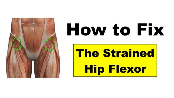 Fixing Hip Flexor Pain – Squat University Squat University, Crossfit Mobility, Lower Back Pain Remedies, Hip Flexor Pain, Bodybuilding Exercises, Pregnancy Back Pain, Hip Strengthening Exercises, Hip Flexor Exercises, Bursitis Hip