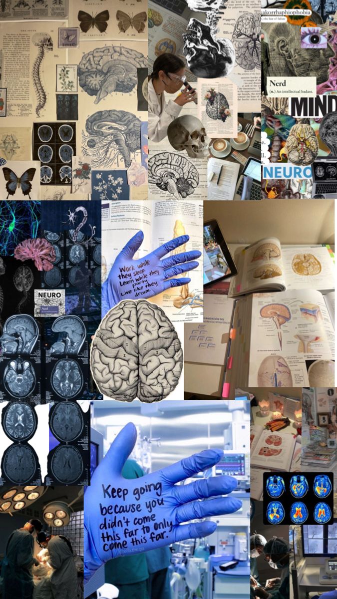 a collage of photos with different types of brain images and words on them, including hands in blue gloves