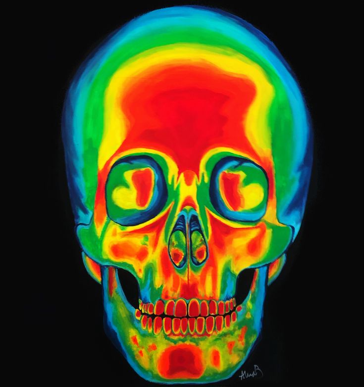 an image of a human skull with different colors