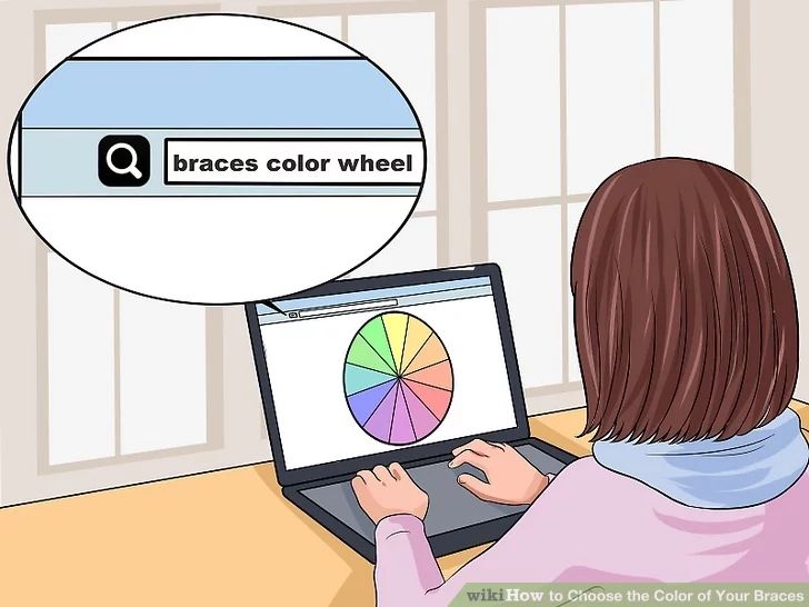 How to Choose the Color of Your Braces: 14 Steps (with Pictures) Braces Color Wheel, Braces Colors, Your Shoes, Color Wheel, A Color, Braces, Your Style, How To Become, Color