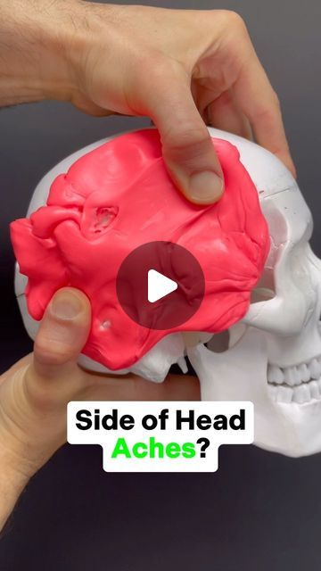 Dr. Joe Damiani - TMJ, Head & Neck Specialist on Instagram: "Do you do you experience pain on the side of the head? 
Do you have a headache and it’s above your ear or by your temple?
Maybe even above the eye or closer to the back of the head behind the ear? 

Well, if it is coming from a muscle referral. There are three among others that typically refer to this area:

💪🏼 Upper Trapezius
💪🏼 Sternocleidomastoid
💪🏼 Splenius Capitus

In this video, I show how to release each of the three. If you release one at a time, it will help you to further identify which one gives your pain… in other words do one one day, then wait a day do the next way to do it they do the next and see which is most effective. This is how I work every day with clients to figure out the root cause of their issue. Temple Headache Causes, Temple Headache, Shoulder Rehab, Side Of Face, Headache Causes, Back Stretching, Headache Types, Head Pain, Back Of The Head