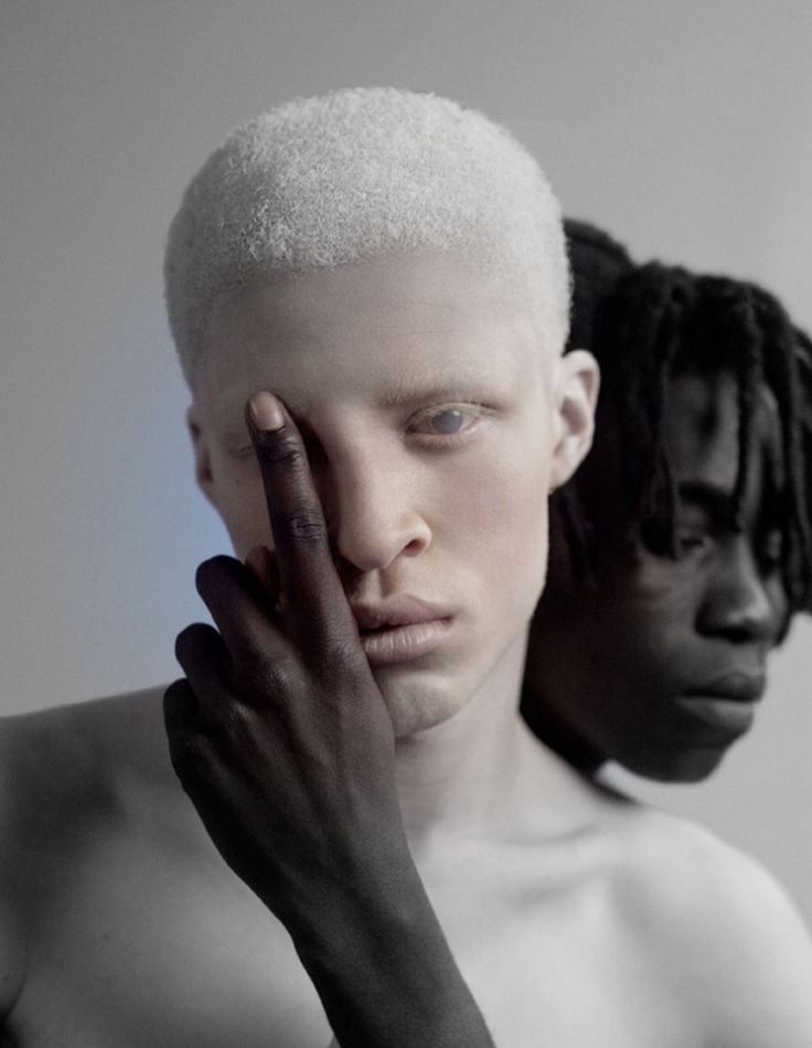 two black men with white hair and no shirts, one holding his hand to his face