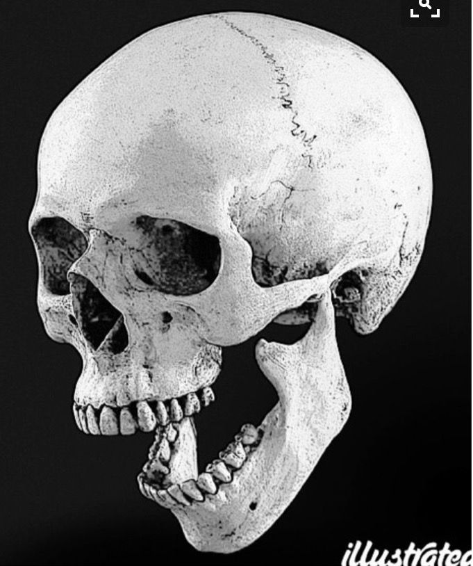 a black and white photo of a human skull with the lower jaw missing from it