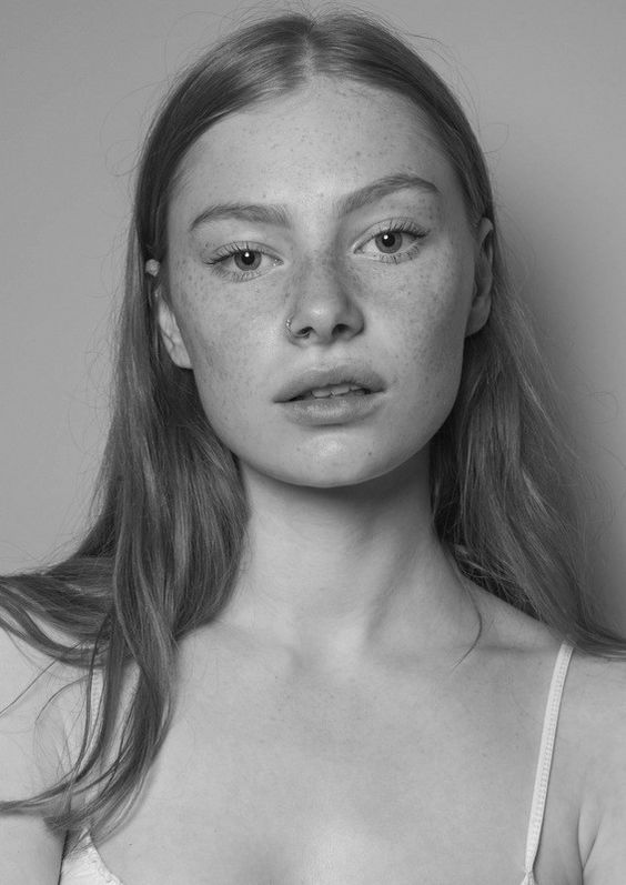 a black and white photo of a woman with freckles on her face, looking at the camera