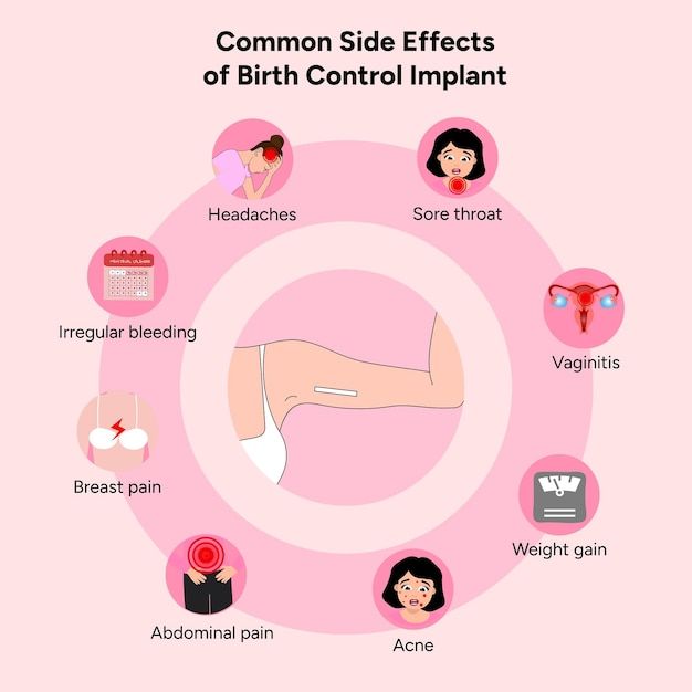 the common side effects of birth control implants infographical illustration on pink background