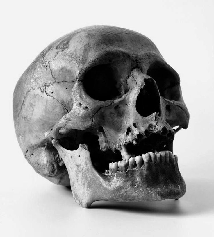 a black and white photo of a human skull on a white background with the lower jaw missing