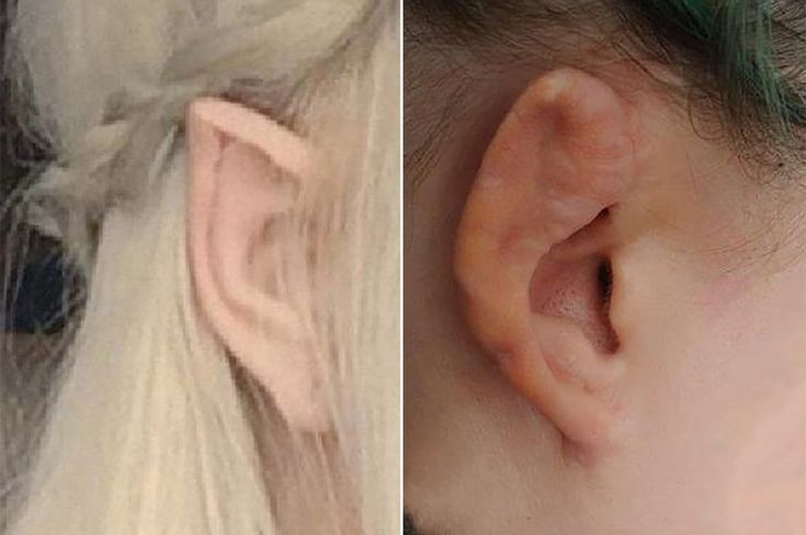 two pictures of the same person's ear before and after their haircuts