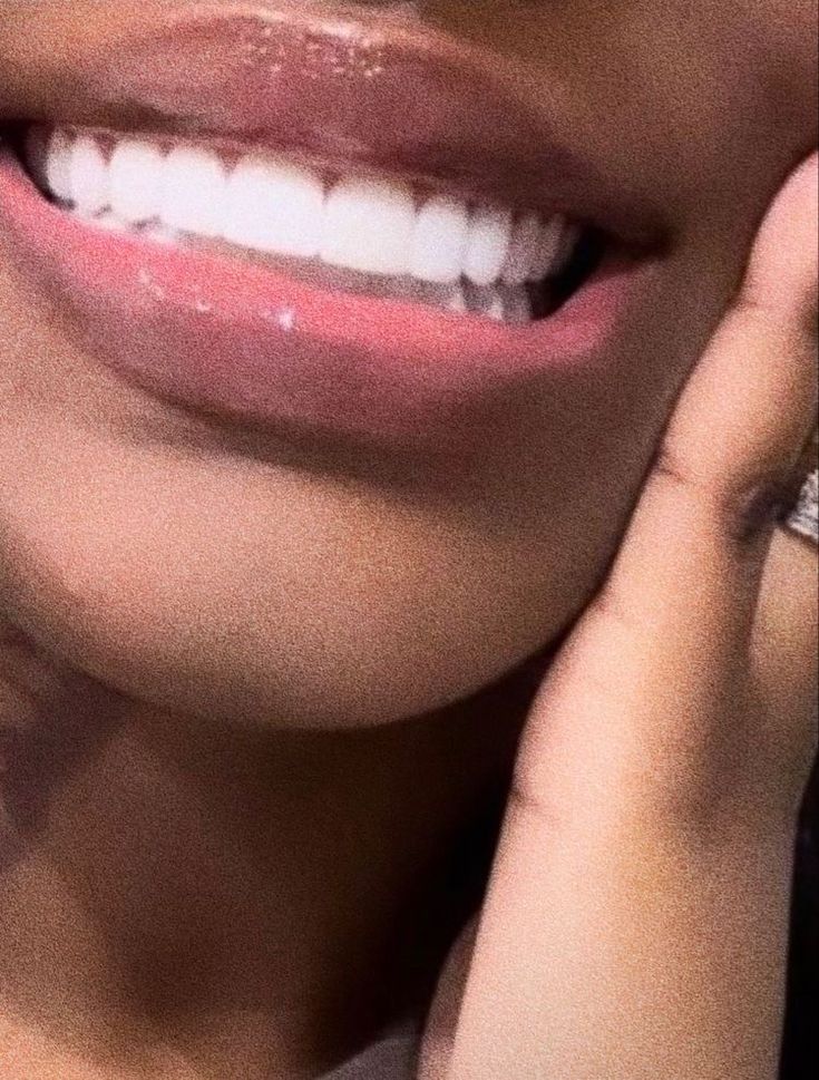 Teeth Aesthetic, Pretty Teeth, Straight Teeth, Perfect Teeth, Smile Teeth, White Smile, Teeth Whitening Kit, Perfect Smile, Teeth Care