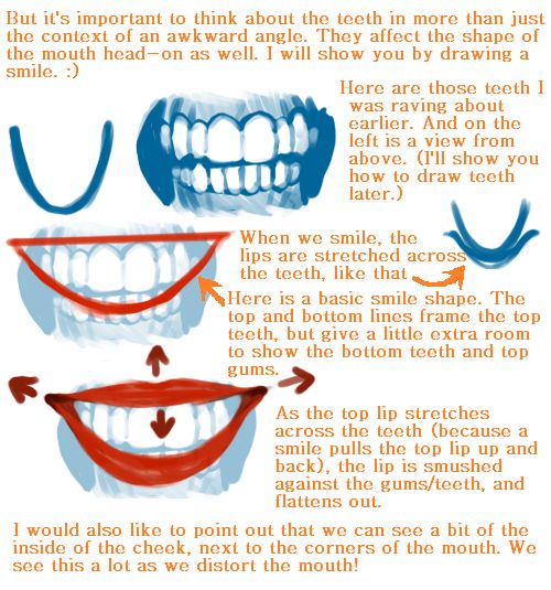 an image of teeth with different expressions