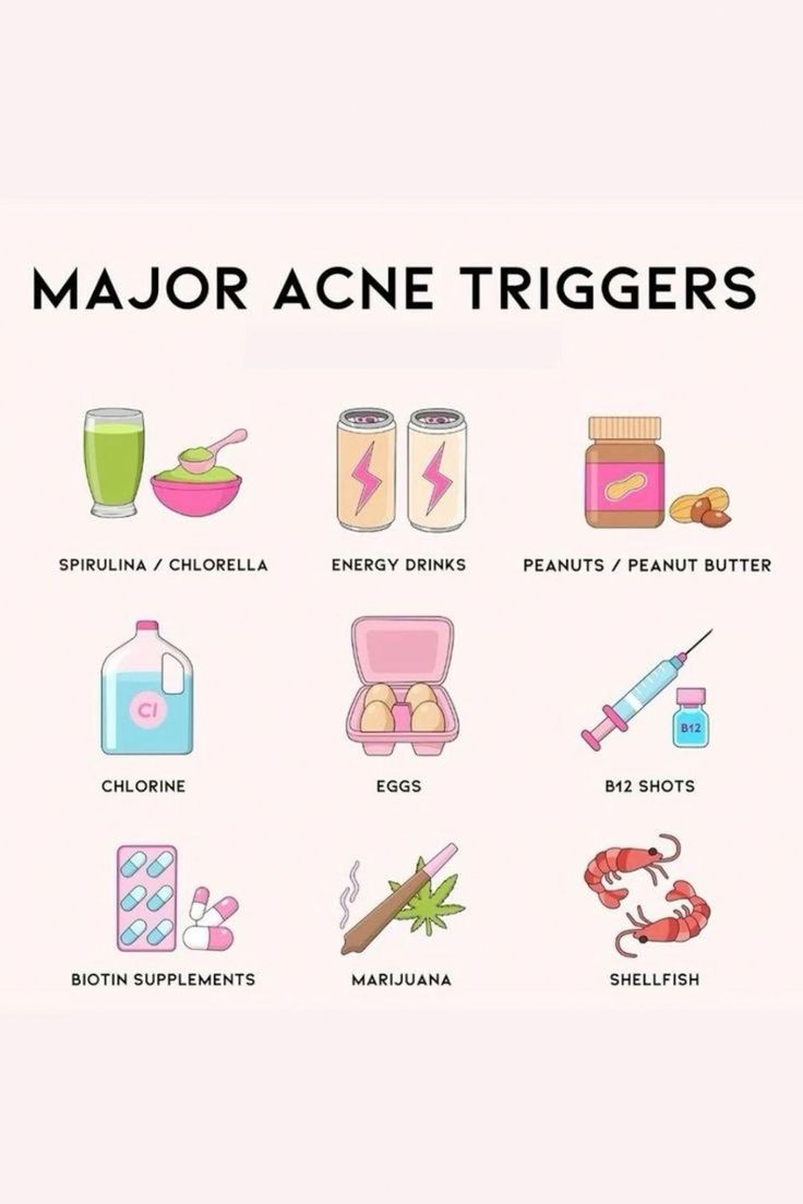 Acne Triggering Foods, Tips To Prevent Acne, Foods That Are Bad For Your Skin, How To Prevent Acne Breakouts, Skin Care For Breakouts, Hormonal Acne Routine, Acne Trigger Foods, Hormonal Acne Diet Clear Skin, How To Keep Your Skin Clear