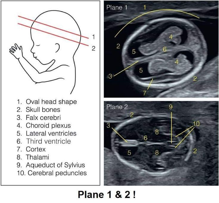 Obgyn Sonography Student, Ardms Obgyn, Ultrasound Technician School, Diagnostic Medical Sonography Student, Ultrasound School, Obstetric Ultrasound, Arte Ganesha, Cardiac Sonography, Sonography Student