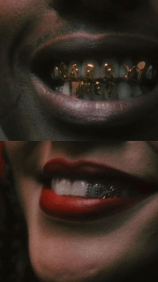 two pictures of the same woman's teeth with braces and piercings on them