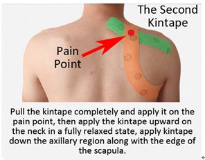 Back Taping, Shoulder Kt Taping, How To Tape Shoulder For Pain, Kinesiology Taping Stomach, Kt Tape Shoulder, Kt Tape Neck And Shoulder Pain, Kinesiology Taping Shoulder, Shoulder Kinesio Taping, Kinesiology Taping Hip