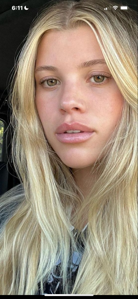 Lip injections #filler #lipfillersstyles Scandi Hairline, Scandinavian Hairline, Dermal Fillers Lips, Lips Inspiration, Botox Lips, Facial Aesthetics, Lip Filler, Viral On Tiktok, Baby Lips