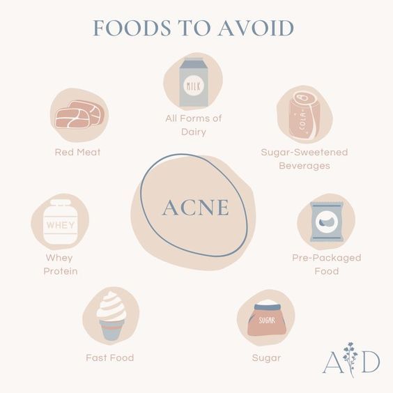 foods to avoid for acne, heal your skin, acne Face Acne Remedies, For Acne Skincare, Food For Acne, Acne Causing Foods, Foods For Clear Skin, Clear Skin Diet, Health Aesthetic, Aesthetic Health, Skin Advice