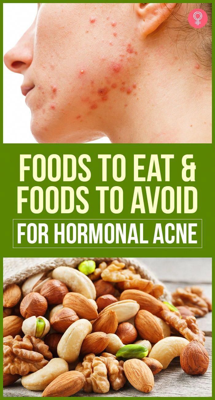 You probably always thought that acne was a thing of the past and that you won’t have to deal with it once you reach adulthood. Then, once you actually stepped into adulthood, you discovered that acne isn’t just a puberty problem. Good Face Wash, Food For Acne, Acne Beauty, List Of Food, Acne Diet, Good Face, Foods For Healthy Skin, Skin Diet, Best Face Wash