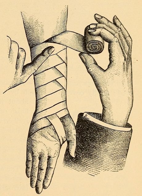 an old drawing of two hands with bandages on their wrists and one hand holding something in the other