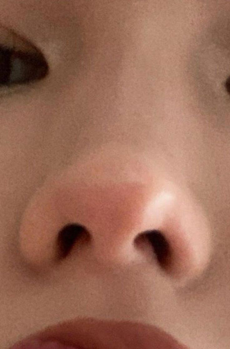 Cute Button Nose, Desired Nose, Upturned Nose, Snub Nose, Baby Nose, Nose Types, Tiny Nose, Pretty Nose, Perfect Nose