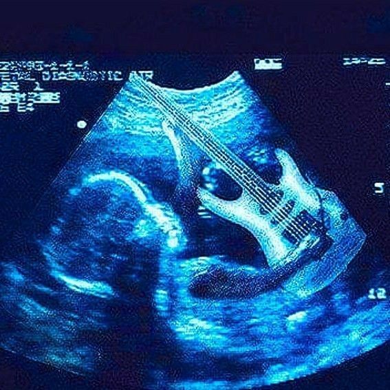 an x - ray image of a guitar in the shape of a human stomach is shown