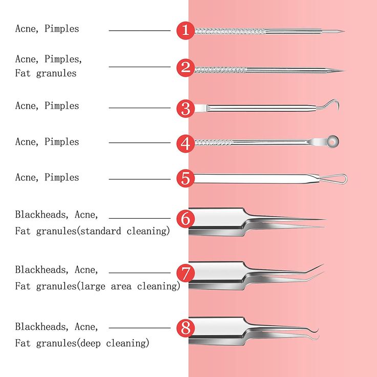 Extraction Tools Facial, Esthetician Vs Aesthetician, Esthetician Student Notes, Esthetician Supply List, Beginner Esthetician Tips, Esthetician Start Up Supplies, Esthetician Test, Beginner Esthetician Supply List, Esthetician Needs