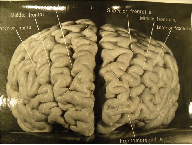 an image of a human brain with labels on it