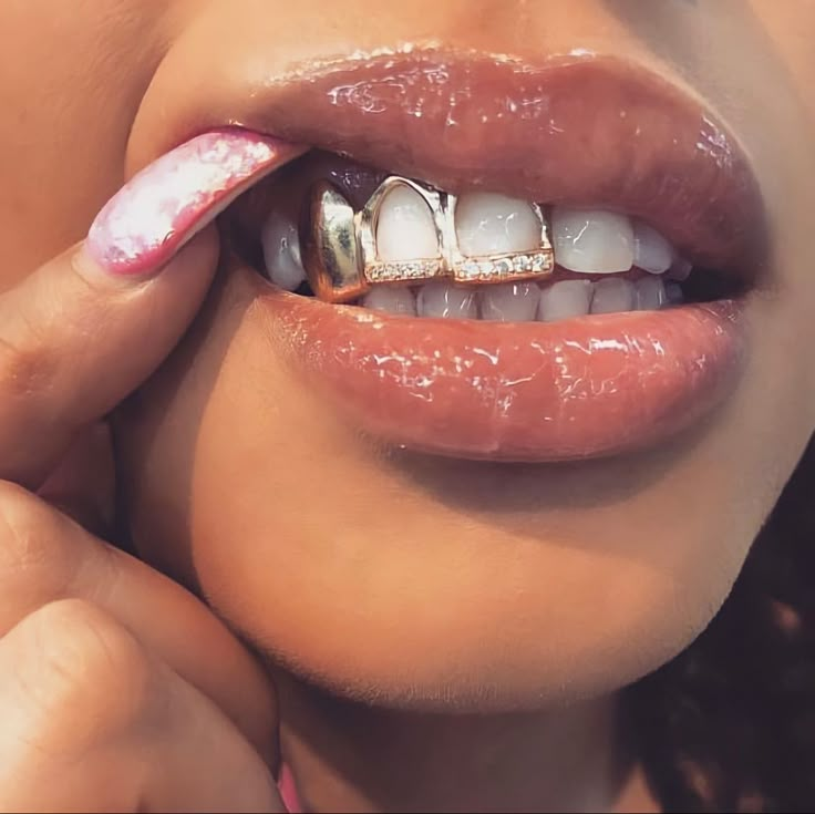 a woman with braces on her teeth is holding her hand to her chin and looking at the camera